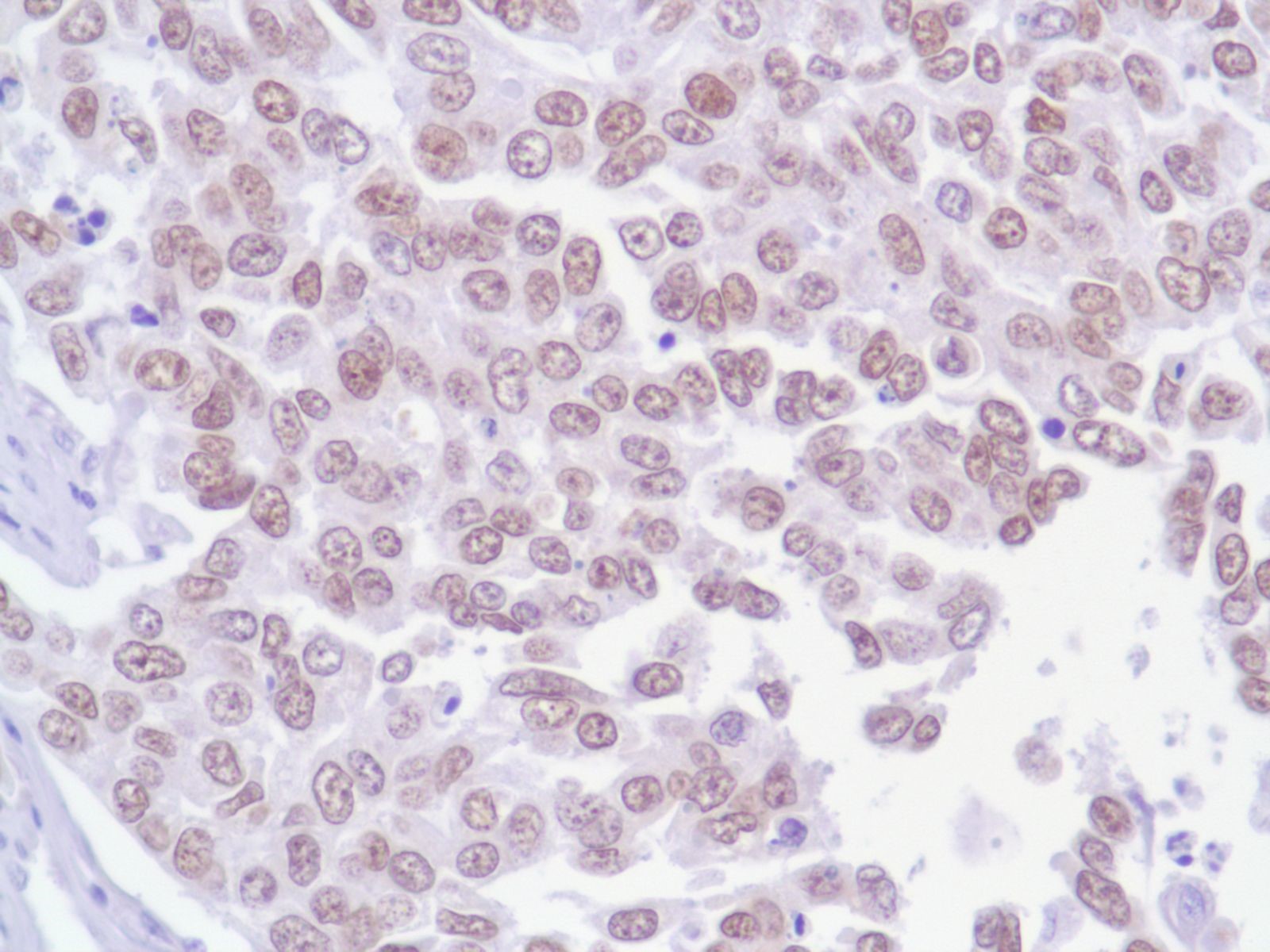 Anti-FOXA1 antibody [SP88] （#ARG53038）の免疫組織染色像