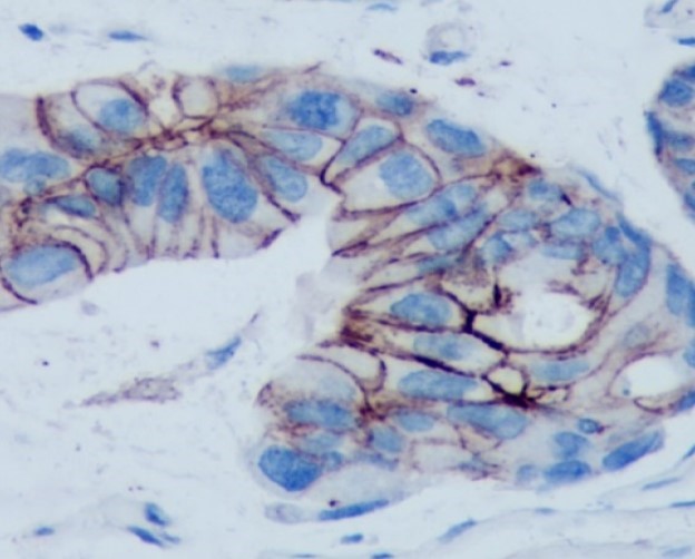 Anti-E-Cadherin antibody [SQab1717] （#ARG66195）の免疫組織染色像