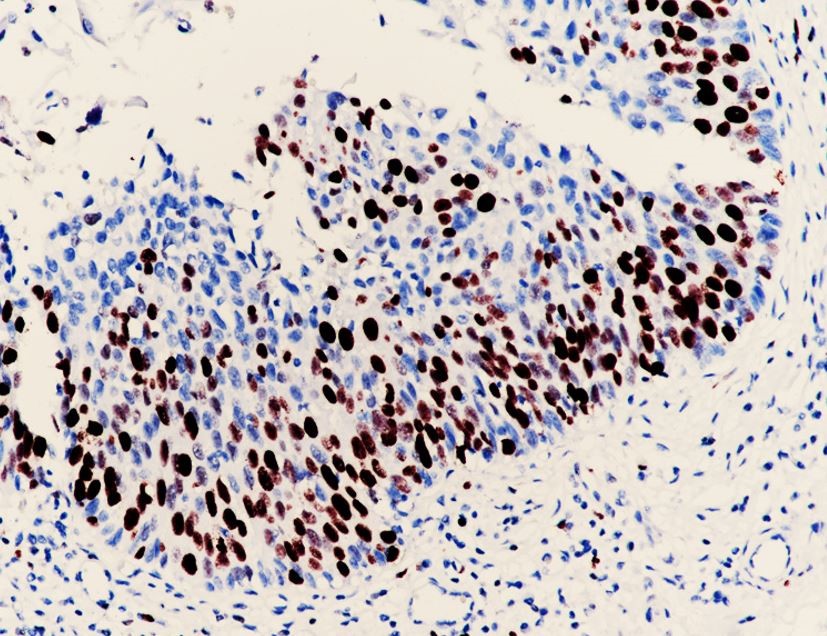 Anti-Ki-67 antibody [SQab1897] （#ARG66347）の免疫組織染色像