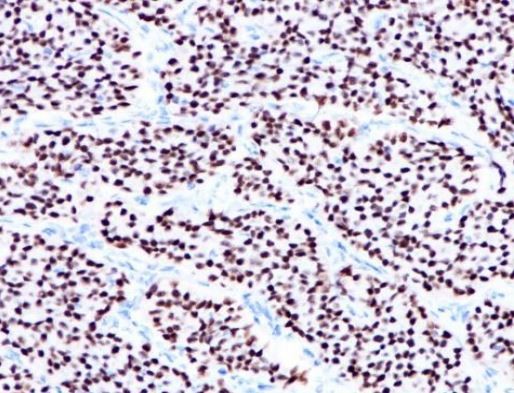 Anti- ER-α antibody [SQab1889] （#ARG66356）の免疫組織染色像