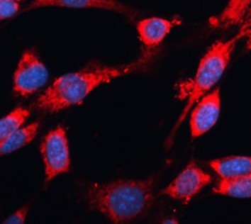抗カスパーゼ3抗体（#ARG54938）を用いた免疫細胞染色（IC/IF）像