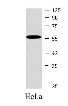 抗GSDME抗体（#ARG42602）を用いたウエスタンブロッティング（WB）像