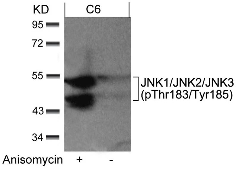 Anti-JNK1/JNK2/JNK3 phospho(Thr183/Tyr185)のウエスタンブロット像