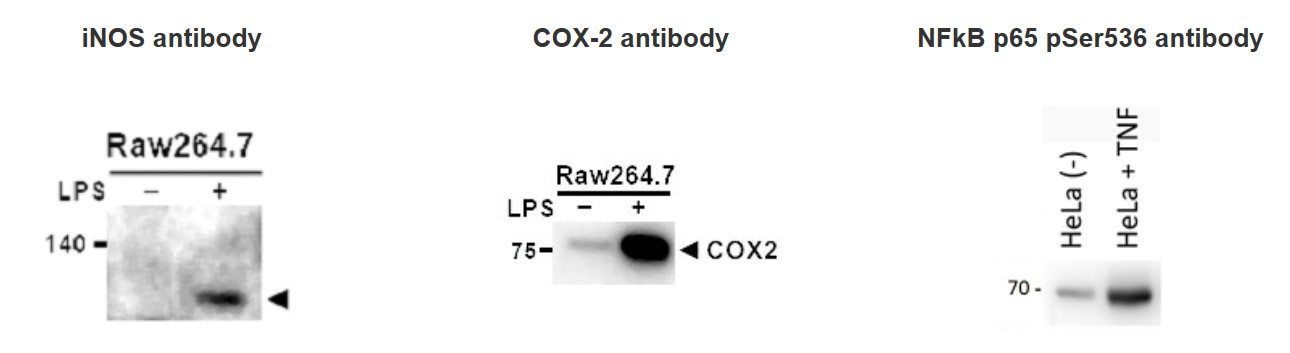 Inflammation Antibody Panel（#ARG30323）を用いたウエスタンブロット像