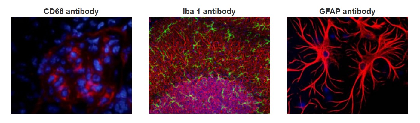 Neuroinflammation Antibody Panel（#ARG30324）を用いた免疫蛍光染色像像
