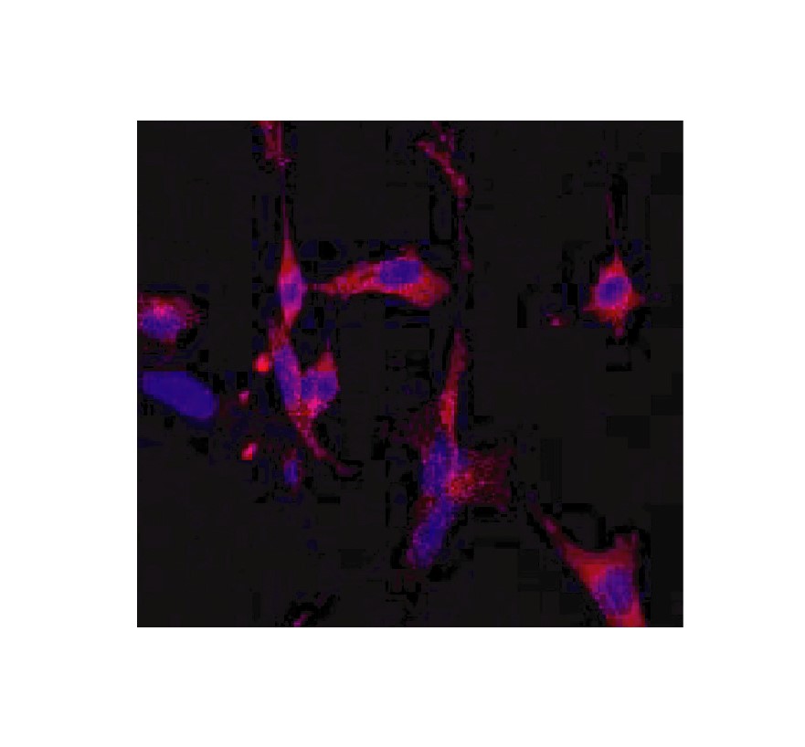 使用例：図1.Anti-RIPK1/RIP1の免疫蛍光染色像