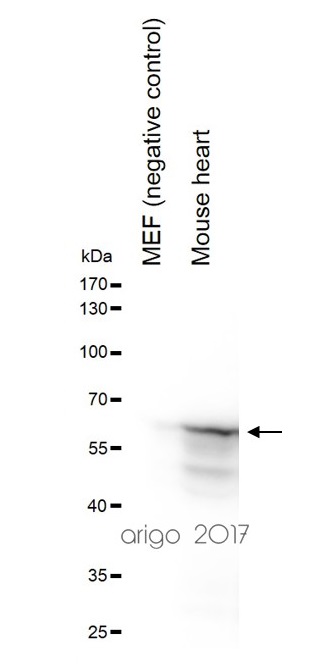 anti-Desmin antibody WB image