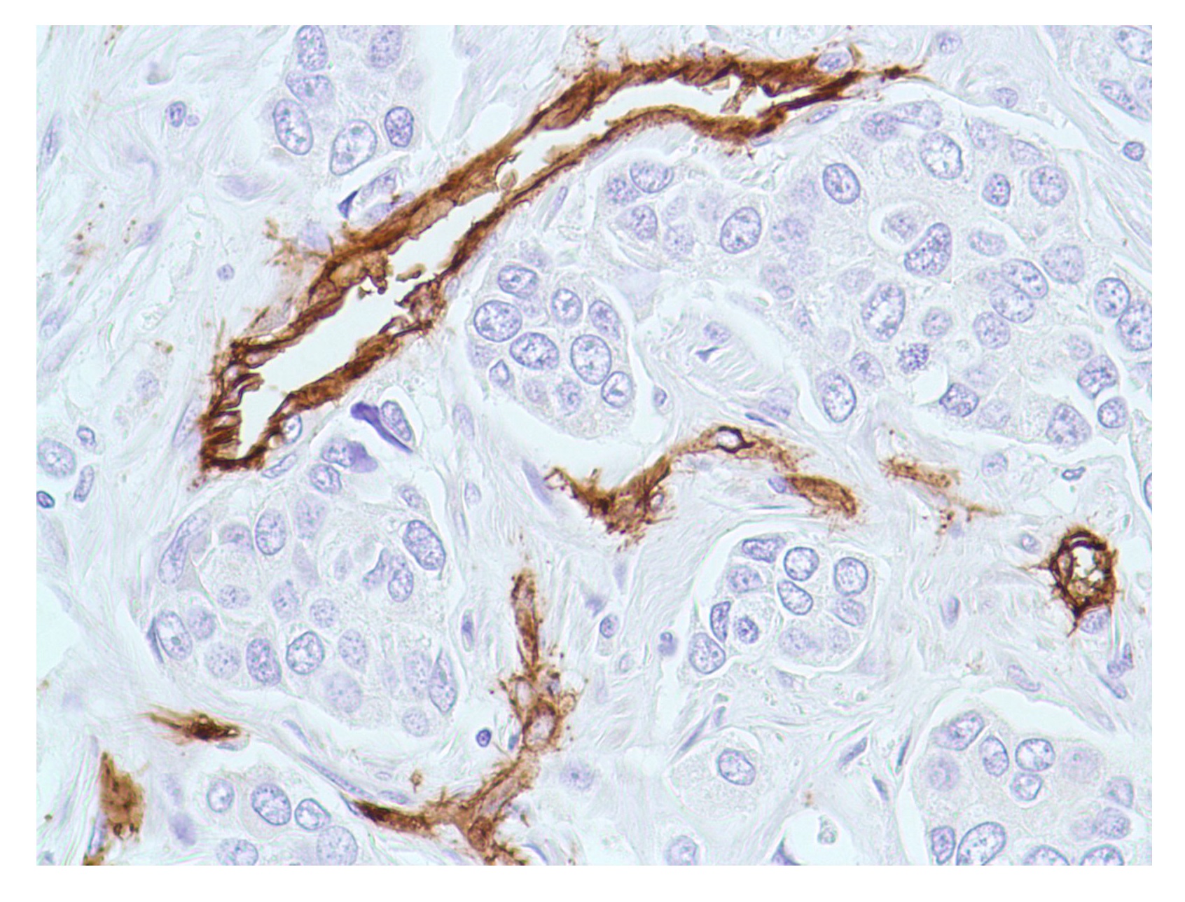 anti-CD34 antibody [QBEND/10] IHC-P image