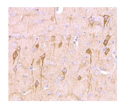 anti-NG2 / Chondroitin sulfate proteoglycan 4 antibody IHC-P image
