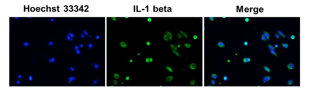 Anti-IL-β の免疫蛍光染色（IC/IF）像