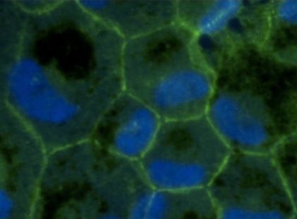 ARG55738を用いたヒト初代網膜色素上皮細胞の免疫組織染色