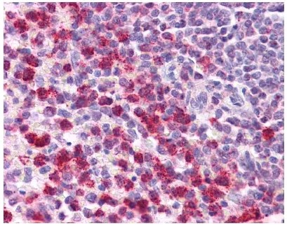 #ARP37894_P050を用いたヒト脾臓組織の免疫組織染色像