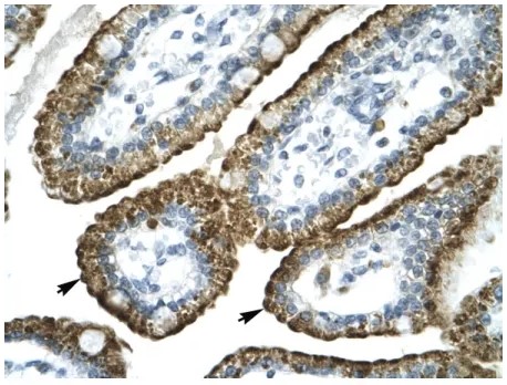 #AVARP13034_P050を用いたヒト腸組織の免疫組織染色像