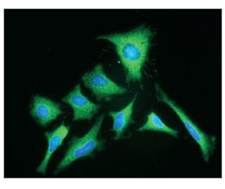 抗ヒトPKM-2抗体の免疫蛍光染色像（HeLa細胞）