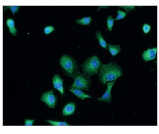 抗ヒトPKM-2抗体の免疫蛍光染色像（A549細胞）