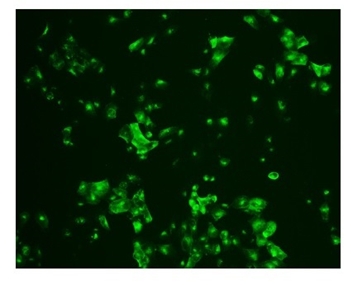 Fig.1 SARS infected cells were stained by clone 3A2.