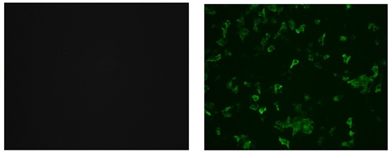 Fig.3 SARS-CoV-2 infected cells were stained by clone 3A2 (Left) or positive control antibody (Right).