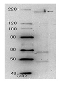 Fig.4 SARS spike glycoprotein was detected by clone 3A2.