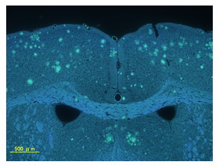 特殊染色 チオフラビンS染色(マウス脳）