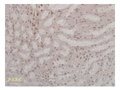 8-OHdG（ラット腎臓）免疫染色