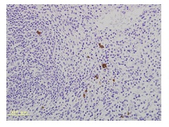 MCP-1（マウス脾臓）免疫染色