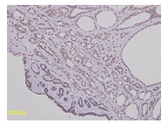 Estorogen R （マウス卵巣）免疫染色
