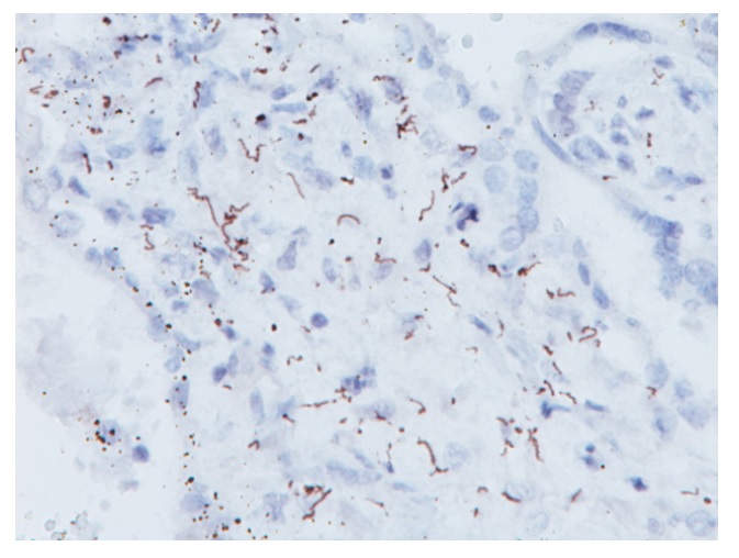 抗スピロヘータ抗体を用いた免疫染色画像