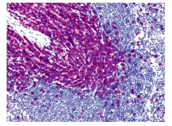 ウサギ抗マウスCD3 抗体を用いた免疫染色像