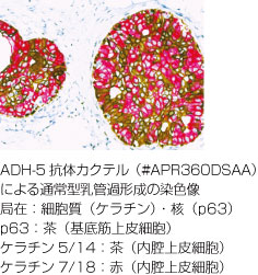 ADH-5抗体カクテル 染色図
