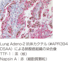 Lung Adeno-2抗体カクテル免疫染色図