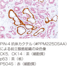PIN-4抗体カクテル免疫染色図