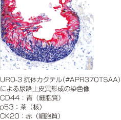 URO-3抗体カクテル免疫染色図