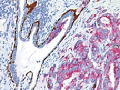 前立腺組織の免疫染色像