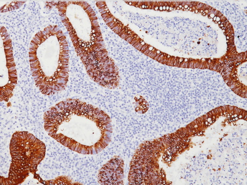 抗cytokeratin 20 (CK20)抗体 (#ACR062)による結腸組織の免疫組織染色像