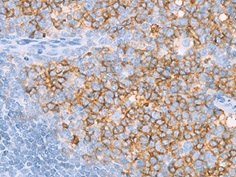 CD10 扁桃腺の免疫染色像
