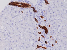 Cytokeratin 19 正常肝臓の胆管の免疫染色像