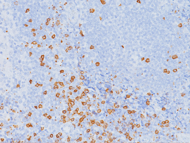 Anti-CD8、Mouse-Mono(BC/1A5) (#ACR154)を用いた扁桃腺組織染色像