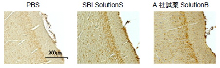 ラット脳凍結切片におけるdimethyl histoneの染色結果