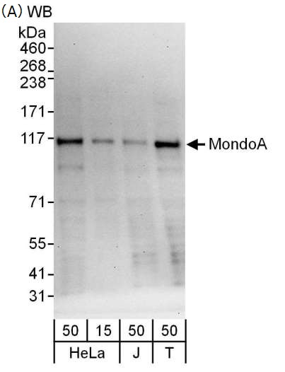 各種細胞ライセート中のMondoAのウェスタンブロットによる検出例