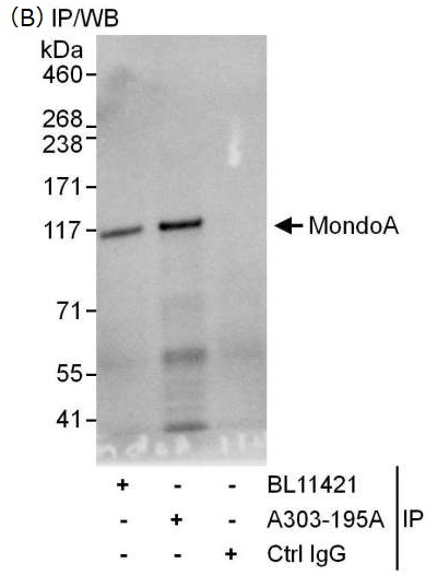 HeLa細胞ライセート中のMondoAの免疫沈降／ウェスタンブロッティング検出例