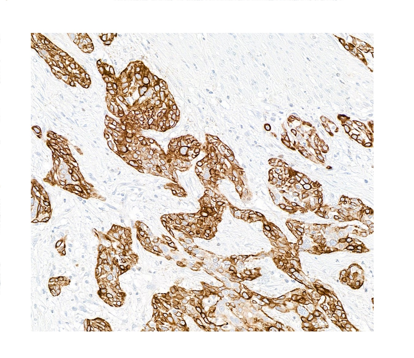 図2. 免疫組織染色像