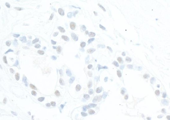 抗TDP2抗体(#HPA008422)のIF像