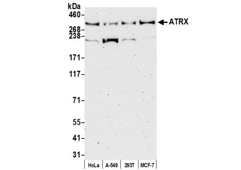 抗MCM6抗体（#HPA004818）のIHC像