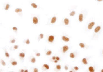 低酸素状態のHeLa細胞中のヒトHIF1-αの免疫染色像