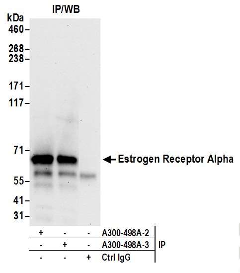 抗ヒトEstrogen Receptor Alpha抗体染色像