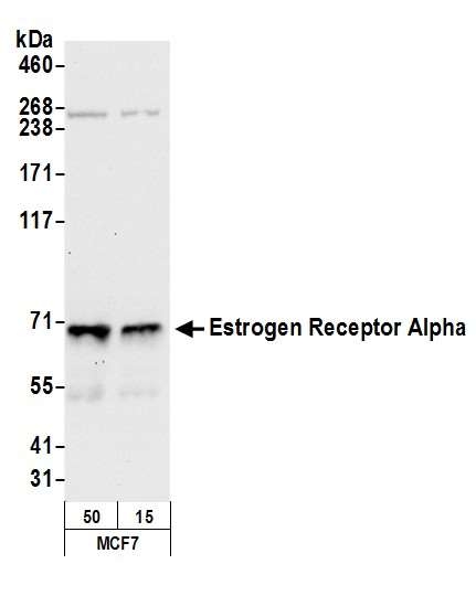 抗エストロゲンレセプターアルファ抗体を用いた染色像