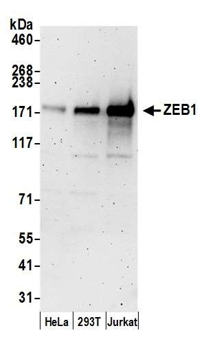 抗ヒトZEB1抗体を用いた染色像