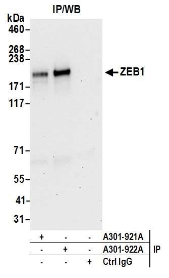 抗ヒトZEB1抗体染色像