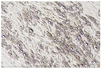 分化誘導培地で培養した脂肪細胞の写真