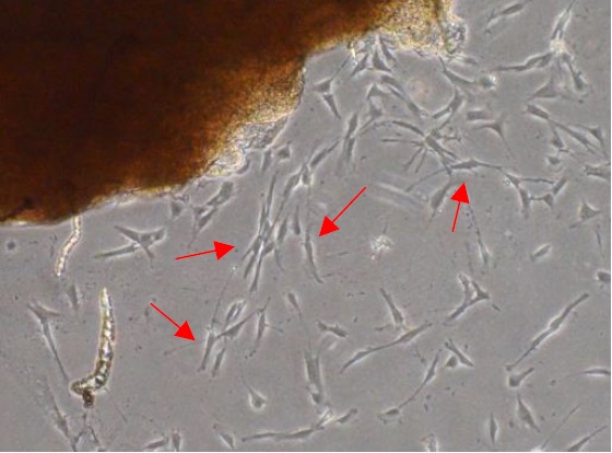 分離した線維芽細胞の写真